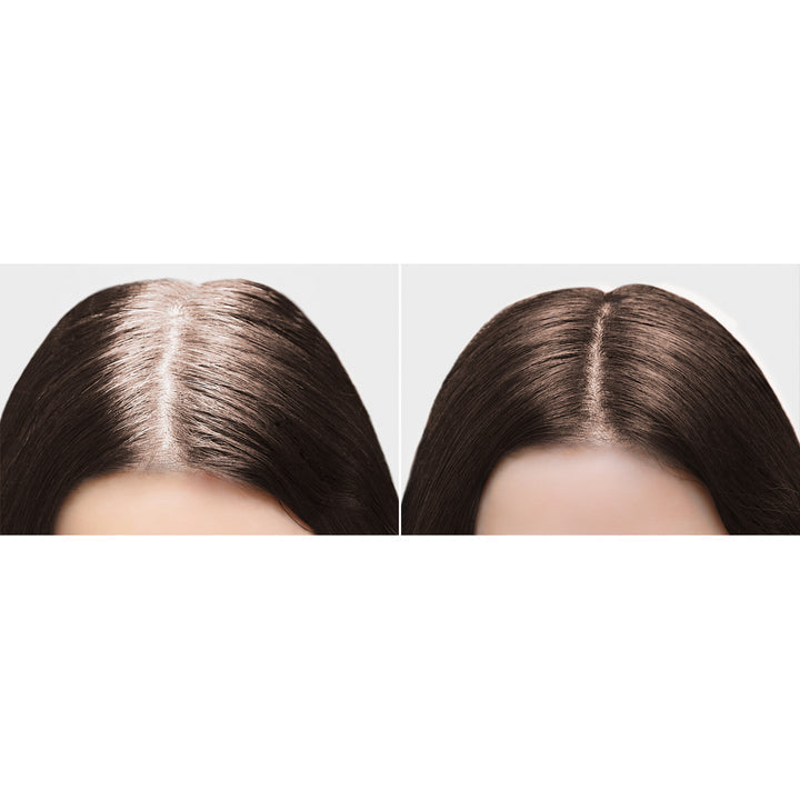 NK ROOT TOUCH-UP