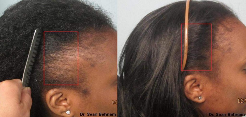 BLACK RICE POWERFUL HAIR GROWTH OIL 2 OZ.