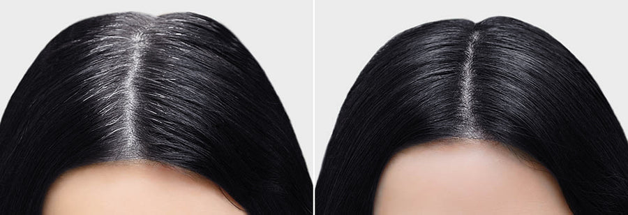 NK ROOT TOUCH-UP