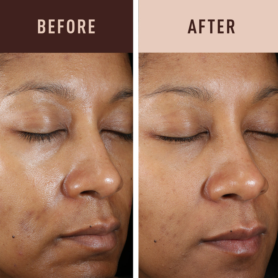 AMBI EVEN & CLEAR FADE CREAM HYDROQUINONE-FREE 1 OZ.