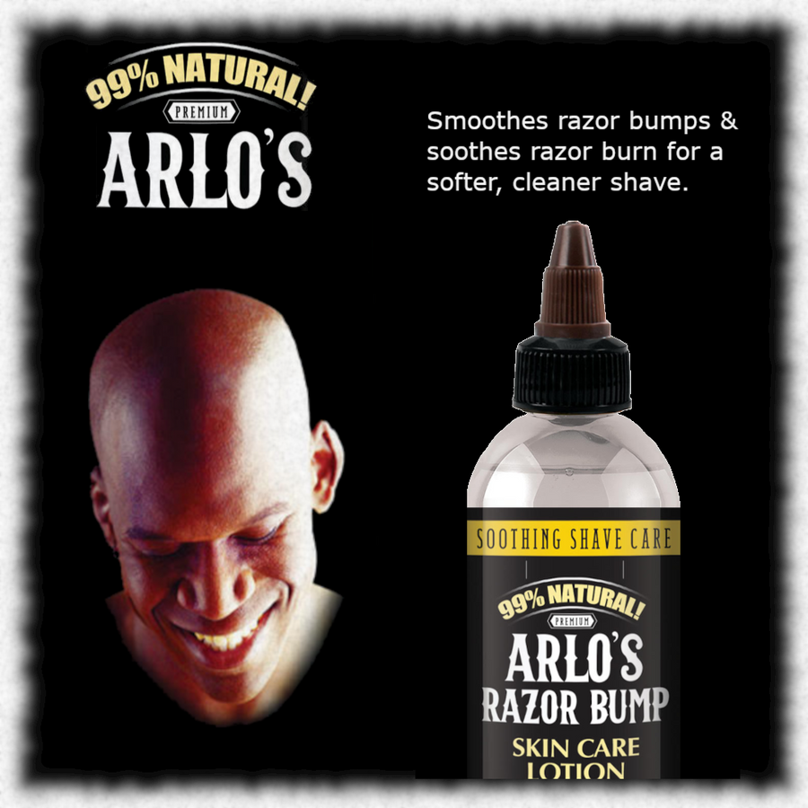 ARLO’S RAZOR BUMP SKIN CARE LOTION 6 OZ.