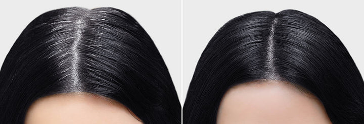 NK ROOT TOUCH-UP