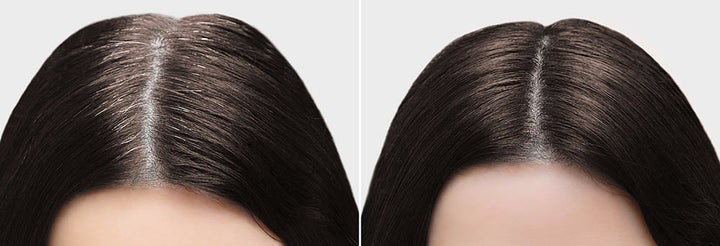 NK ROOT TOUCH-UP