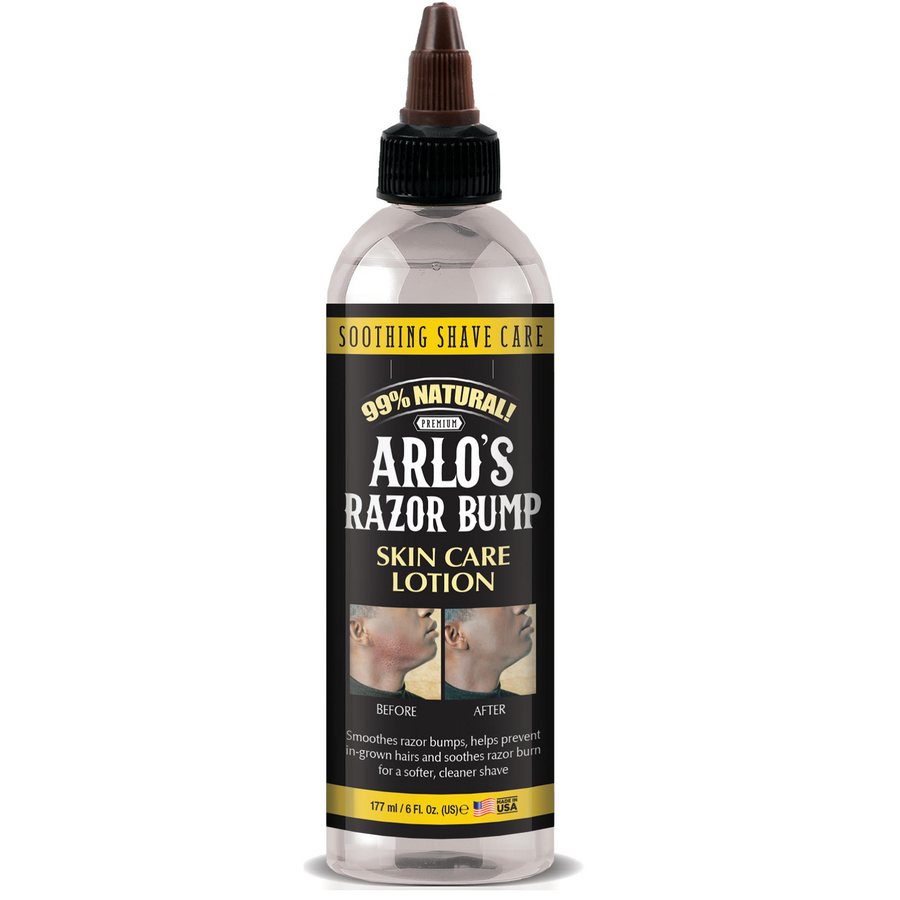 ARLO’S RAZOR BUMP SKIN CARE LOTION 6 OZ.