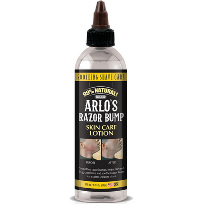 ARLO’S RAZOR BUMP SKIN CARE LOTION 6 OZ.