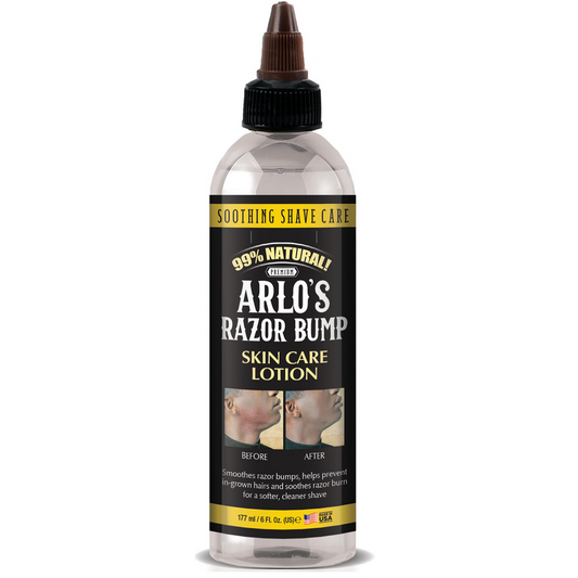 ARLO’S RAZOR BUMP SKIN CARE LOTION 6 OZ.
